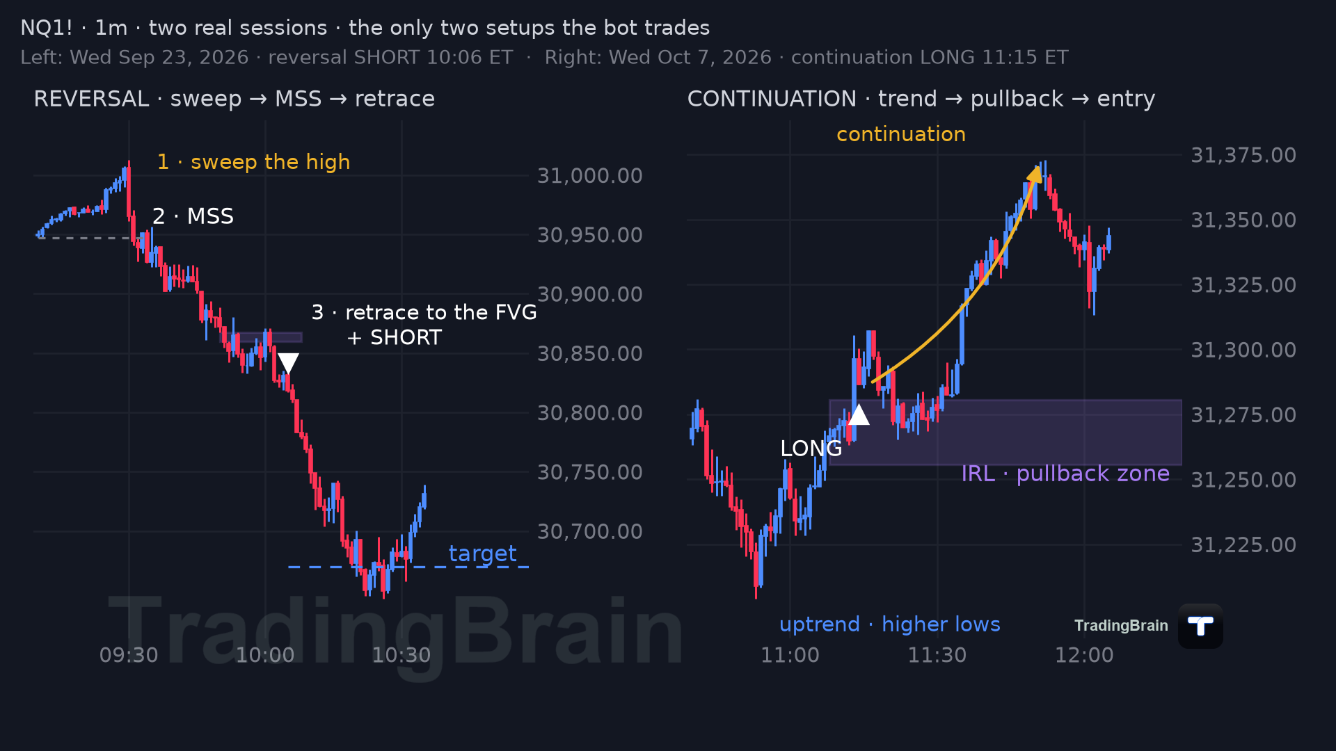 Two real NQ sessions: a reversal (sweep, MSS, retrace) and a continuation (trend, pullback, entry)